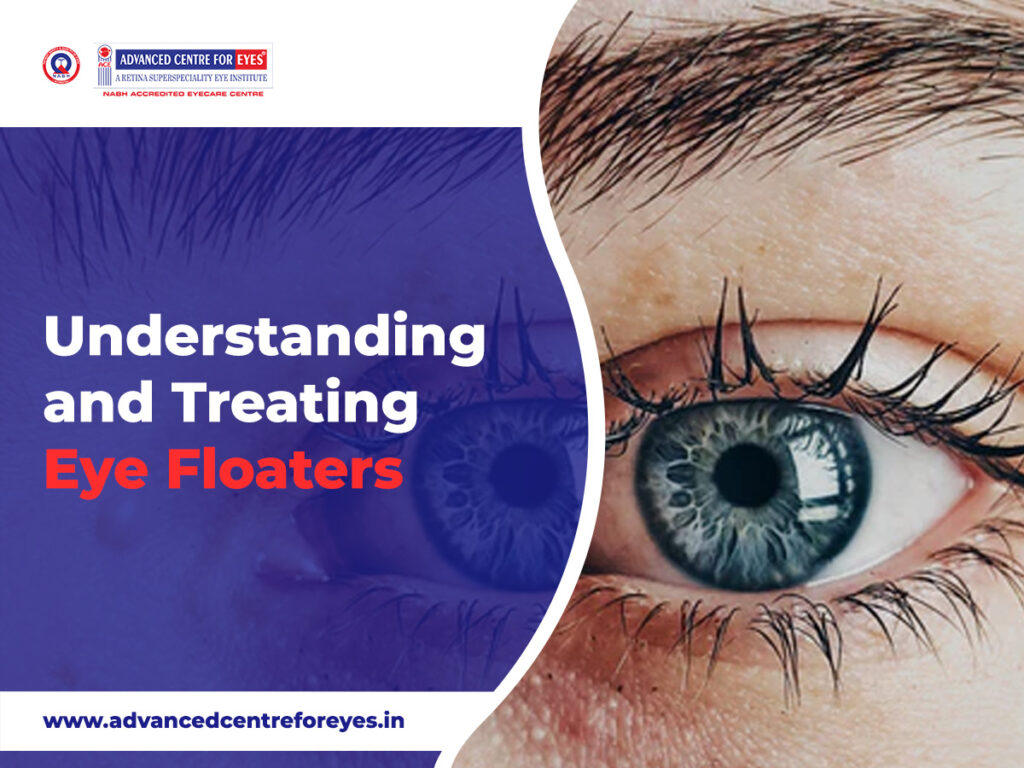 Emergency Eye Care: What to Do in Case of an Eye Injury
