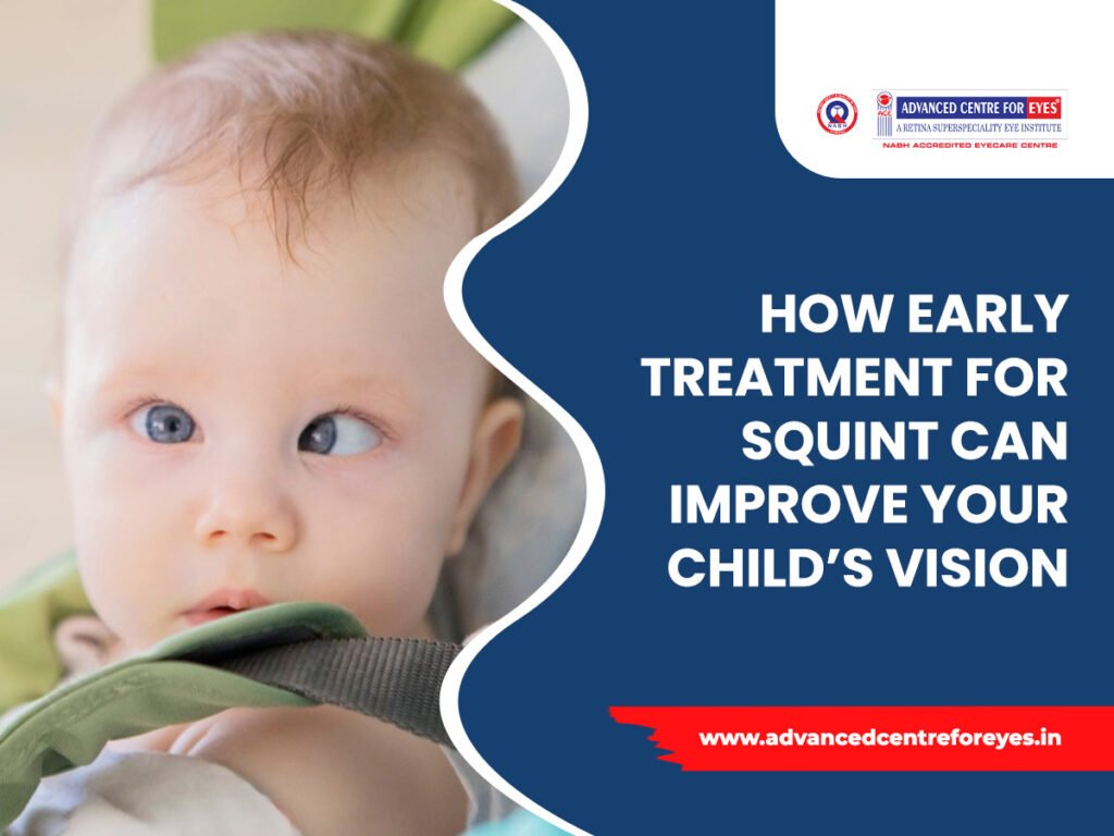 How early treatment for squint can improve your child’s vision?