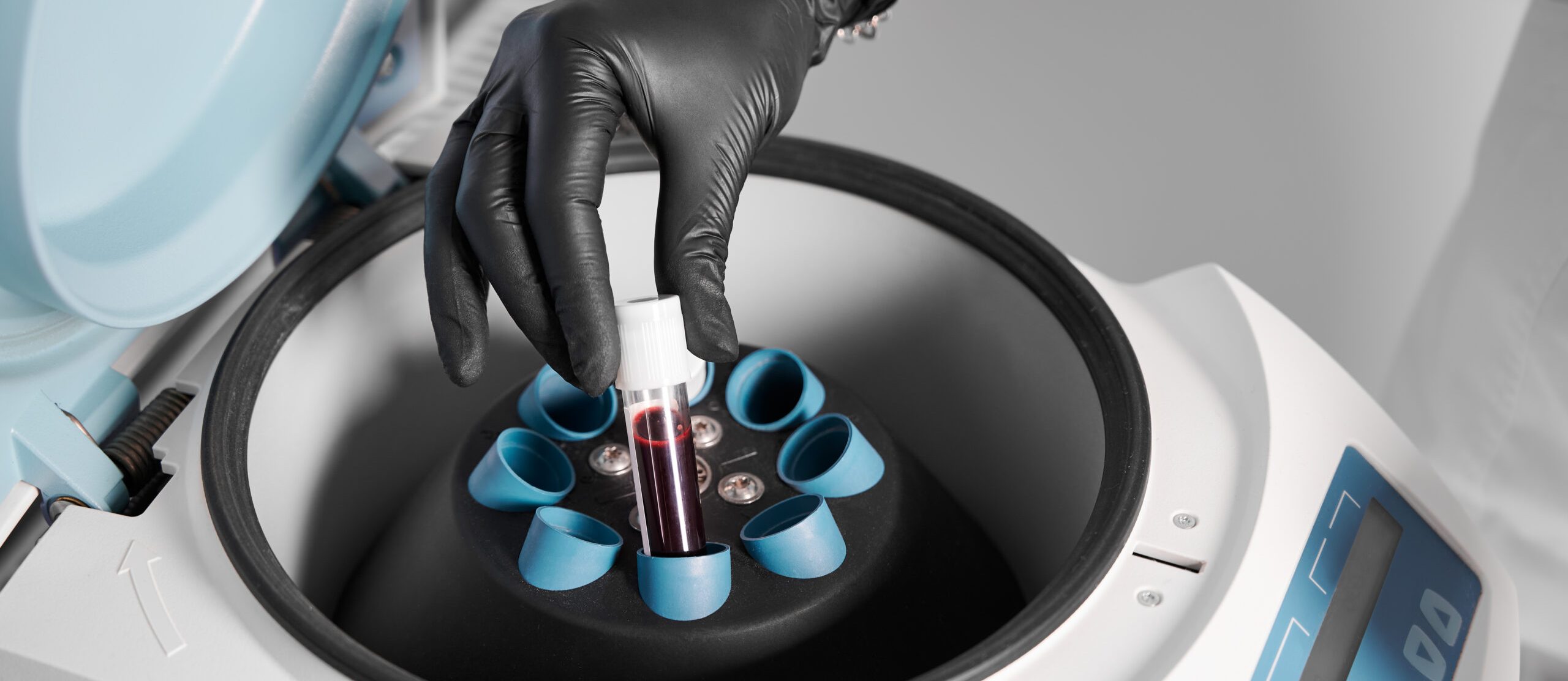 Plasmolifting process. Preparation of blood for injections. Cosmetologist in black rubber glove puts tube of blood in centrifuge. Concept of beauty and health